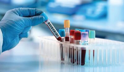 3 Reasons to Get a Blood Test