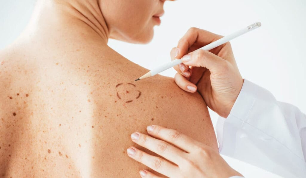 Dermatology in Leicester