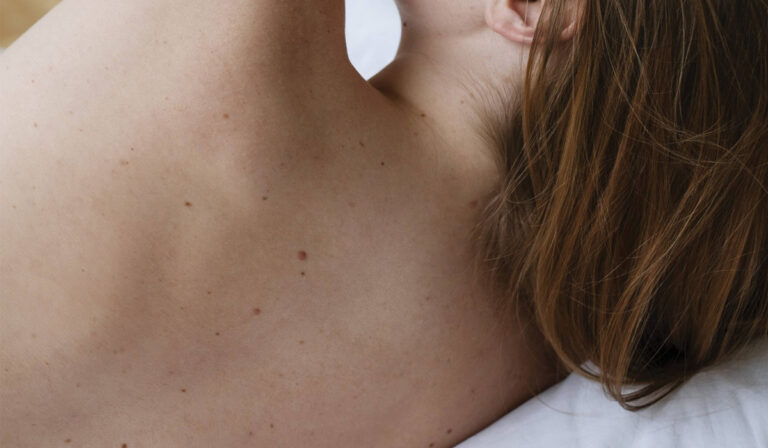 What are moles