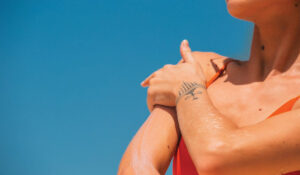 What are skin tags