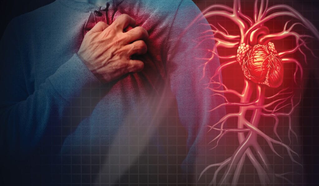 Cardiovascular Disease