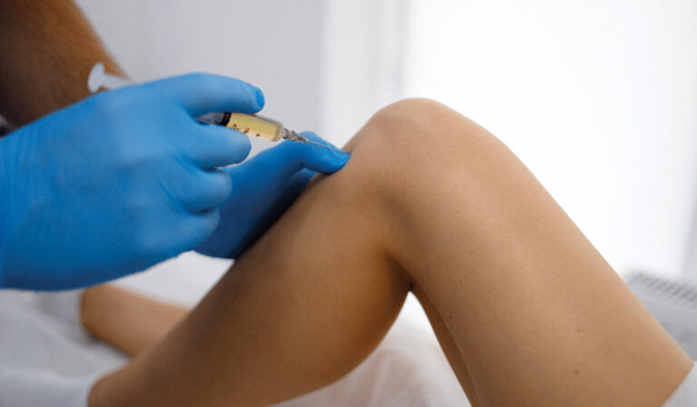 Hyaluronic acid injection to a knee