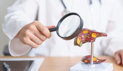 Liver Health Blood Tests