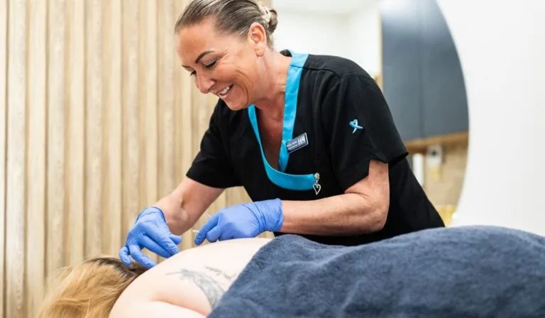 Acupuncture Leicester.jpeg