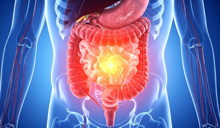 Functional Medicine Tests in Leicester