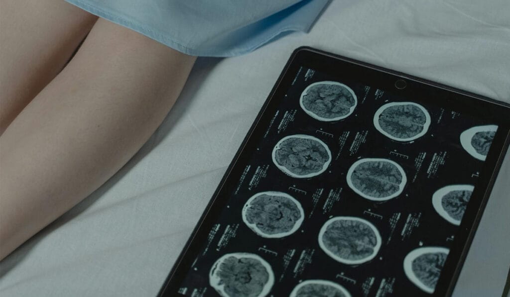 MRI and CT Scanning Referral Leicester