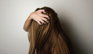 PRP for Hair Loss Leicester