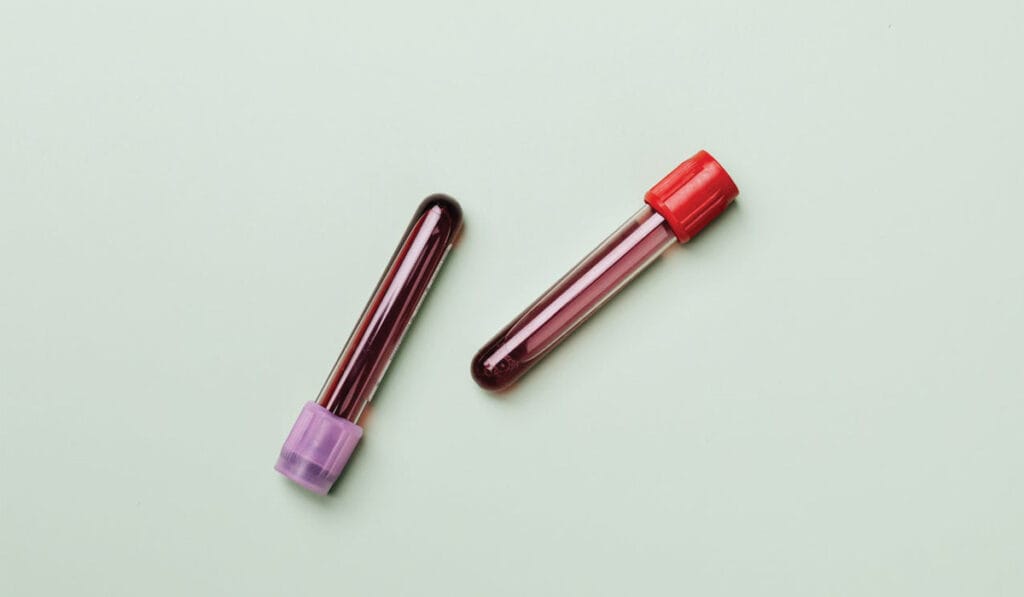 Standard Health Check in Leicester