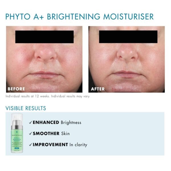 SkinCeutical Phyto A+ Brightening Cream 30ml - Image 7