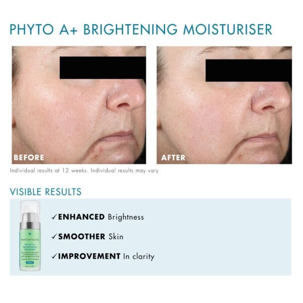 SkinCeutical Phyto A+ Brightening Cream 30ml - Image 8