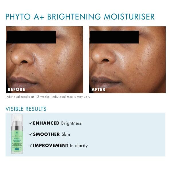 SkinCeutical Phyto A+ Brightening Cream 30ml - Image 9