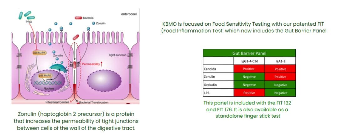 KBMO Stool Testing