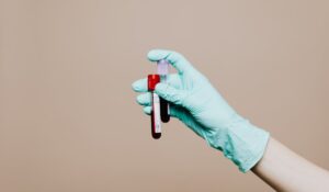 MTIH Blood Test Leicester