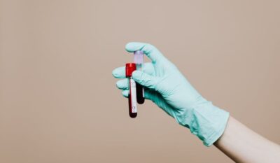 MTIH Blood Test