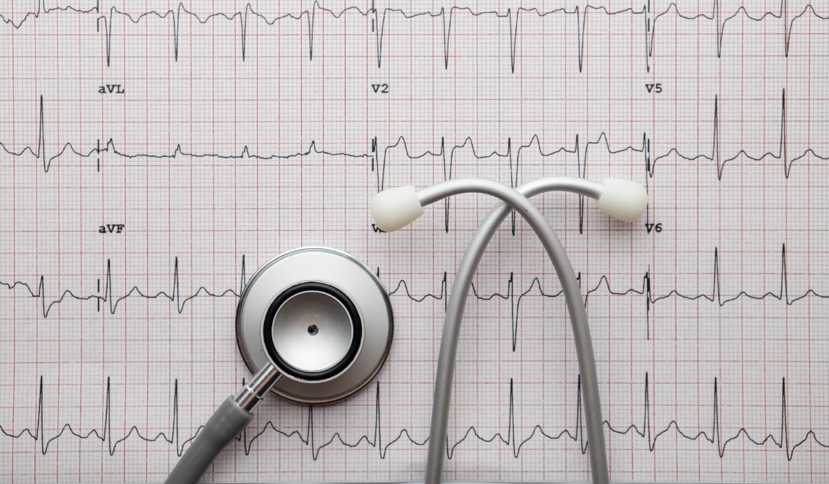 Paediatric ECG (Electrocardiogram) in Leicester