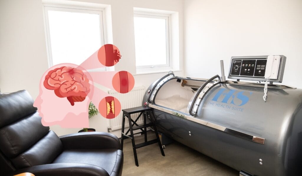 Post Stroke and Hyperbaric Oxygen Therapy