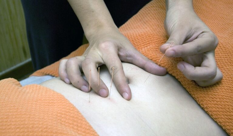 Acupuncture for Digestive & Gastrointestinal Problems in Leicester