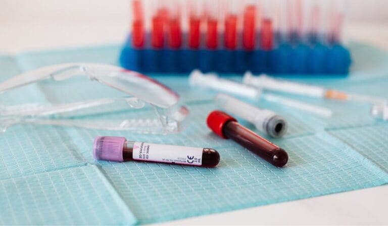 COVID-19 Spike Protein Antibody Test in Leicester