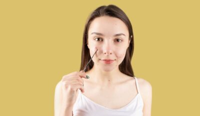 Gut Health and Skin Conditions: The Surprising Connection Explained