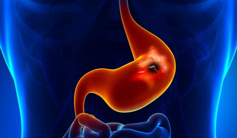 Neuro-Gastroenterology in Leicester