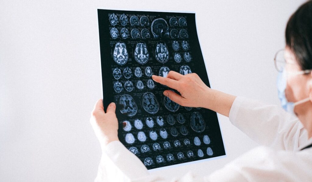 Paediatric Neurology in Leicester