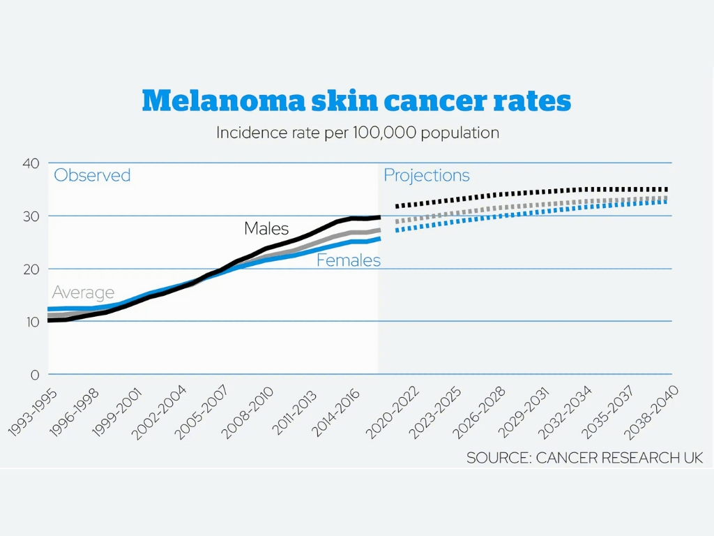 Rates of melanoma