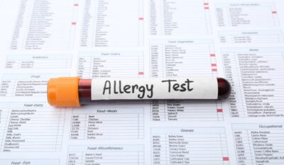 Allergy and Intolerance Testing