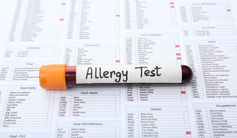 Allergy and Intolerance Testing in Leicester