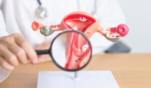 Endometriosis Management in Leicester