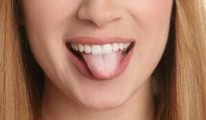 Candida Overgrowth A Nutritionist’s Approach to Treatment