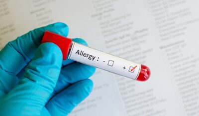 ISAC Molecular Allergy Testing