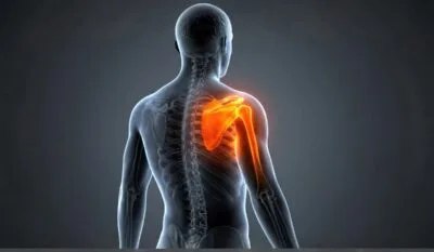 Shoulder Hydrodilatation