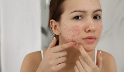 Signs of Early Puberty in Girls and Boys – When to Seek Medical Advice