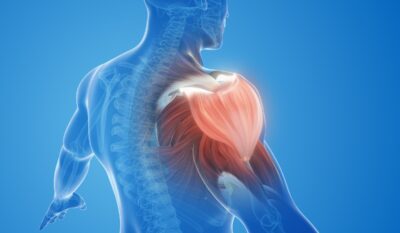 Frozen Shoulder? How Hydrodilatation Can Restore Your Mobility