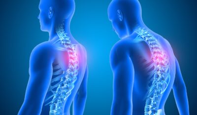 Advanced Posture & Movement Assessment