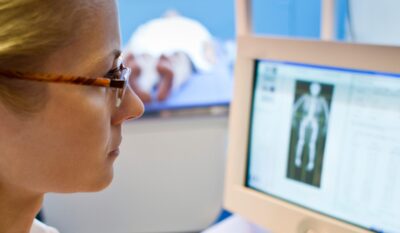 DEXA Bone Density Scan