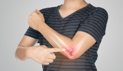 Trabecular bone score: why bone density alone underestimates fracture risk