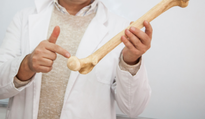 What is a DEXA scan and what does it show?