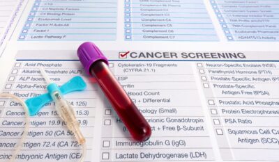 The Galleri Test: its history, the NHS trial, and how to access it privately in the UK