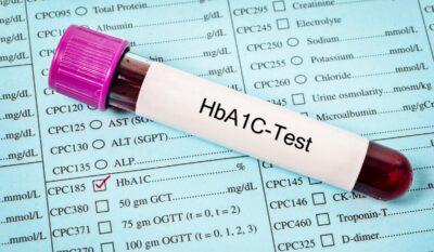 HbA1c Test Explained: What the Numbers Mean and When to Repeat Test