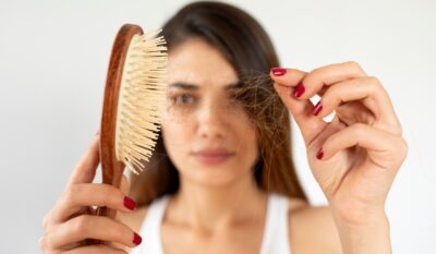 Female Hair Loss: Causes, Tests and the Telogen Effluvium Picture